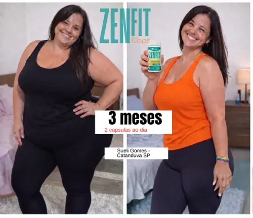 Resultado de tratamento com ZenFit Caps 1